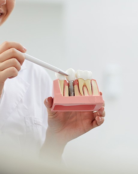 a closeup of a dental implant model