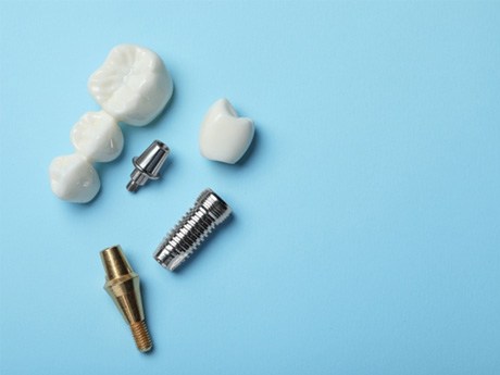 Two dental implants, crown, and bridge on a light blue surface