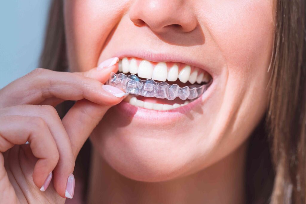 Woman with Invisalign